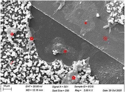 Real-time quantification of osteoclastic resorptive activity by electric cell-substrate impedance sensing